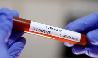 411 нови заразени в неделя, починаха още четирима с коронавирус
