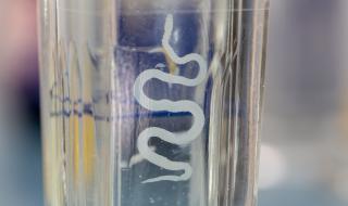 Всеки пети е заразен с опасна инфекция без да подозира