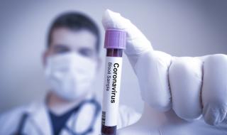 До дни наши лаборатории ще правят бързи тестове за коронавирус