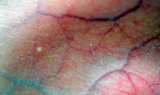 Защо вените ни са сини, щом кръвта ни е червена