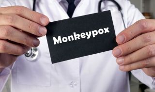 Епидемиолог: По данни от Африка 1 от 10 заболели от маймунска шарка умира
