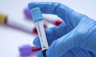 1 350 нови случая на коронавирус, починаха още 13 заразени