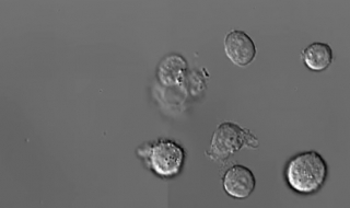 Заснеха видео на смъртта на левкоцитите