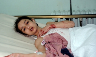 "Примирието" в Сирия взе 150 жертви за ден