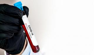 Шефът на БЛС: След 15 дни ще имаме 400 заразени с COVID-19