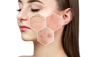 Проблемите с кожата са сигнал за здравословни проблеми с вътрешните органи