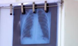 София и Благоевград с най-много заразени за денонощието