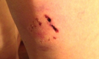 Глутница кучета нахапа двама души в центъра на „Златни пясъци”