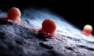 Важен пробив в борбата с рака: Учени откриха как се разпространяват раковите клетки