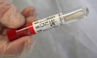 70 нови с коронавирус в неделя, починаха още двама заразени