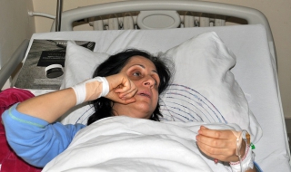 Рецидивист преби жестоко лекарка и я ограби