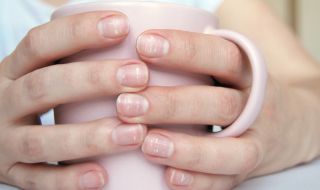 Опасни ли са белите петна по ноктите