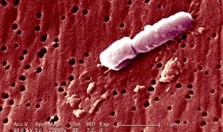 Смъртоносните супер бактерии вече са тук