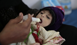 Войната в Йемен е засегнала 1/2 от здравни заведения в страната