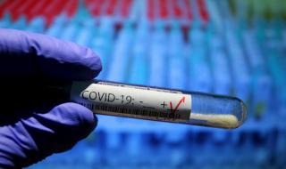 Стряскащ рекорд: 104 заразени с Covid-19 за денонощие