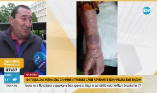 Връзвали 104-годишна жена във видинска болница