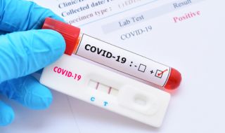 Здравните власти със становище за антителата срещу COVID-19