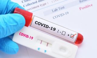 301 нови заразени, починаха още петима с коронавирус