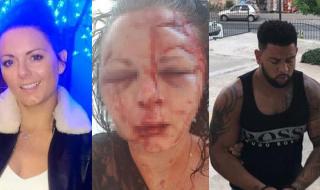 Британка беше пребита брутално в Мармарис