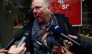 Нападнаха германски журналист в Атина