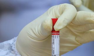 Учен от БАН: Гответе се за 25 000 заразени с COVID-19 в края на септември