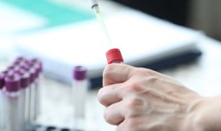 Академик очаква трета имунизация срещу COVID-19