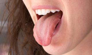 Ако видите това по езика си...