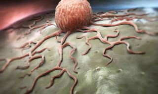 Учени разкриха причината за появата на рака