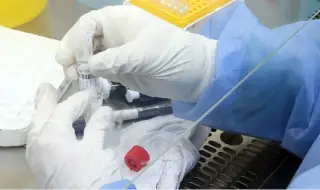 225 нови случая на коронавирус, починаха още шестима заразени