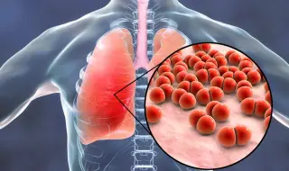 Учени разработиха технология за „умна доставка“ на антибиотици директно в белите дробове