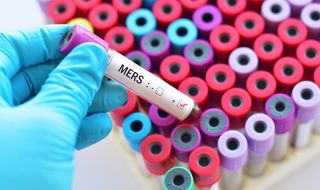 MSN Laboratories започва третата фаза на изпитване на лекарство срещу COVID-19