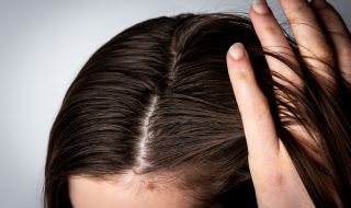 4 начина да се справим с бързото омазняване на косата