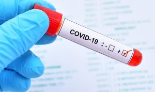 Италиански учени: 99% от починалите от коронавирус са...
