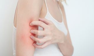 Видите ли това по кожата си, значи сте заразени с коронавирус