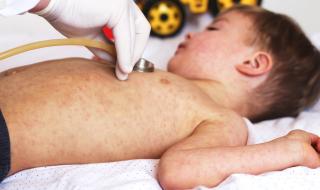 Задължителна ваксина срещу морбили в Германия