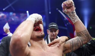 Вижте шокиращи снимки на двойната фрактура на челюстта на боксьор