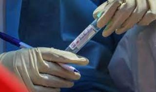 Хоспитализираните с коронавирус паднаха под 500