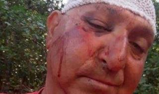 Баща и син пребиха съседите си в село Дъбница