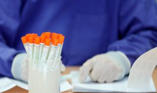 Академик: Топлото време няма да убие коронавируса