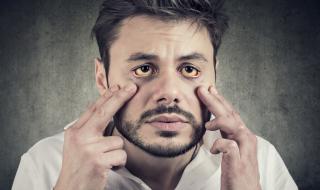 Лицето издава какво е състоянието на черния ви дроб