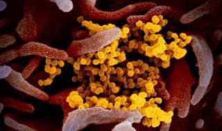 Американците публикуваха снимки на китайския коронавирус