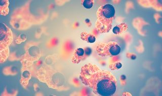 Назоваха най-неочакваните причини за рак