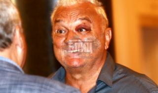 Сашо Диков в парламента с посинено око и сцепена вежда