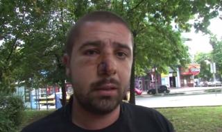 Пострадал при боя в Пазарджик: Полицаите седяха и гледаха (ВИДЕО)