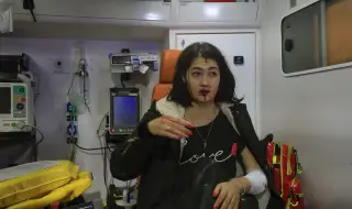 Тежки изгаряния, ампутации: 300 000 ранени цивилни в Украйна