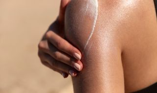 Рак на кожата: Ето какви са признаците и как да се предпазим?
