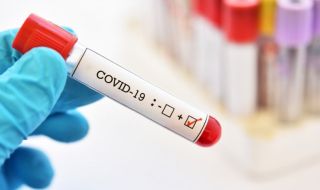 33-ма заразени с коронавирус в неделя, почина един болен