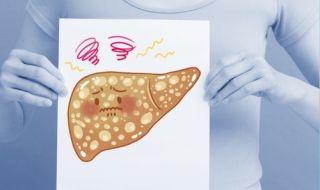 Признаците, че черният ви дроб е пълен с токсини
