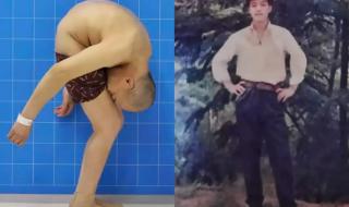 Разпънаха отново мъж, сгънат от страшна болест (СНИМКИ+ВИДЕО)