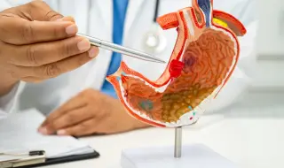 Учени откриха главните причинители на рак на стомаха 